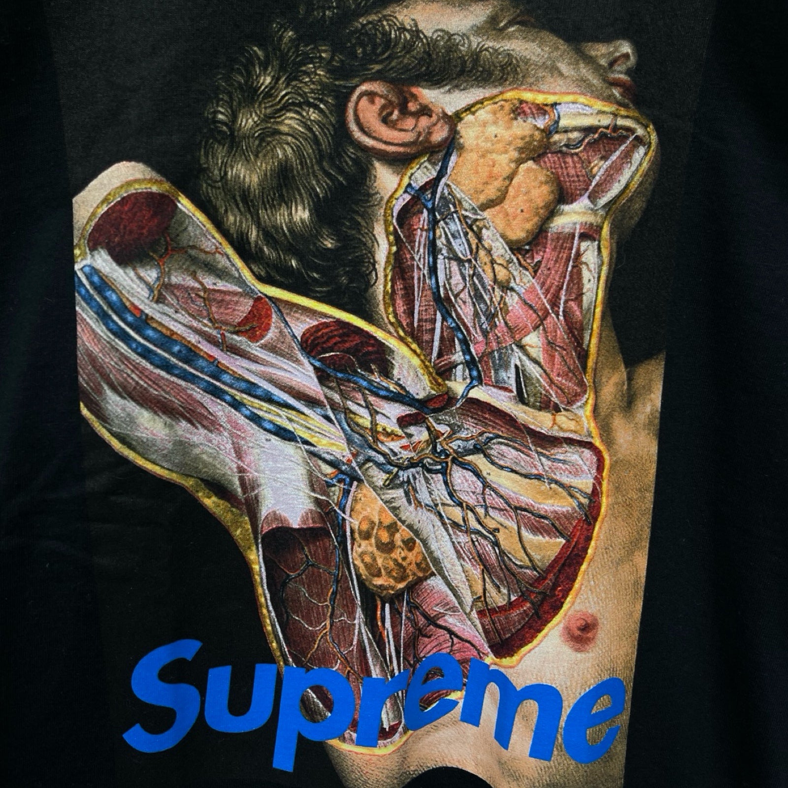 Supreme×UNDERCOVER 2016AW Anatomy Tee Size S